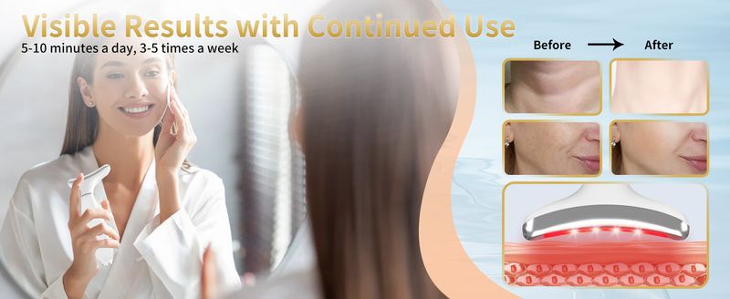 Nackmassageapparat, 7-färgs introduktionsvibration V-face-enhet, Dolphin Neck Beauty Device_voghion.com