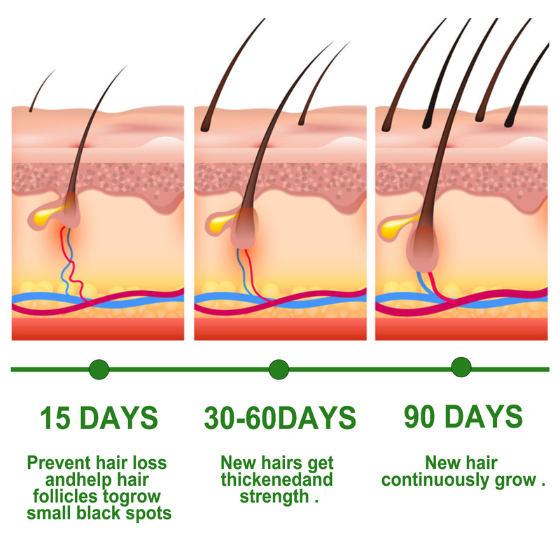 Ätherisches Rosmarinöl, nährt, repariert, verbessert Frizz, beugt Haarausfall vor, beseitigt Juckreiz, verdünnt geschädigtes Haar und pflegt Frauen_voghion.com