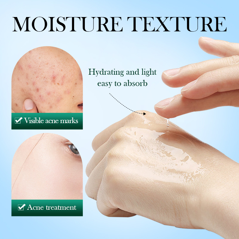 SADOER Tea Tree Acne Removing Toning Water for Students to Moisturize, Nourish, Refreshing, and Nourish Skin_voghion.com