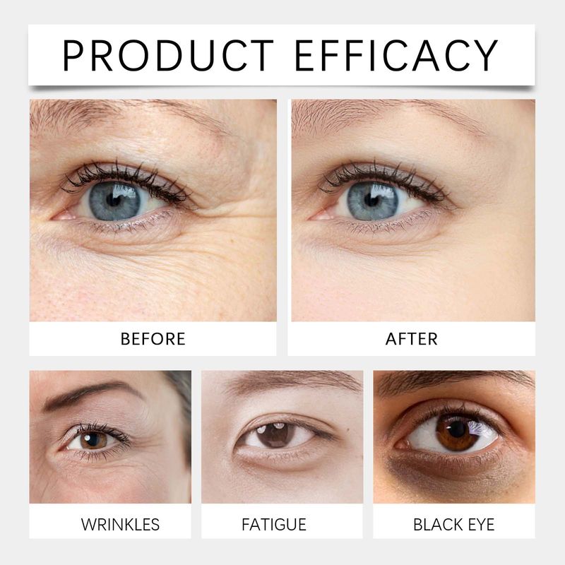 Hoygi Niacinamide Eye Gel Moisturizing Elastic Firming Skin Around The Eye Care Moisturizing Hydrating Eye Cream_voghion.com