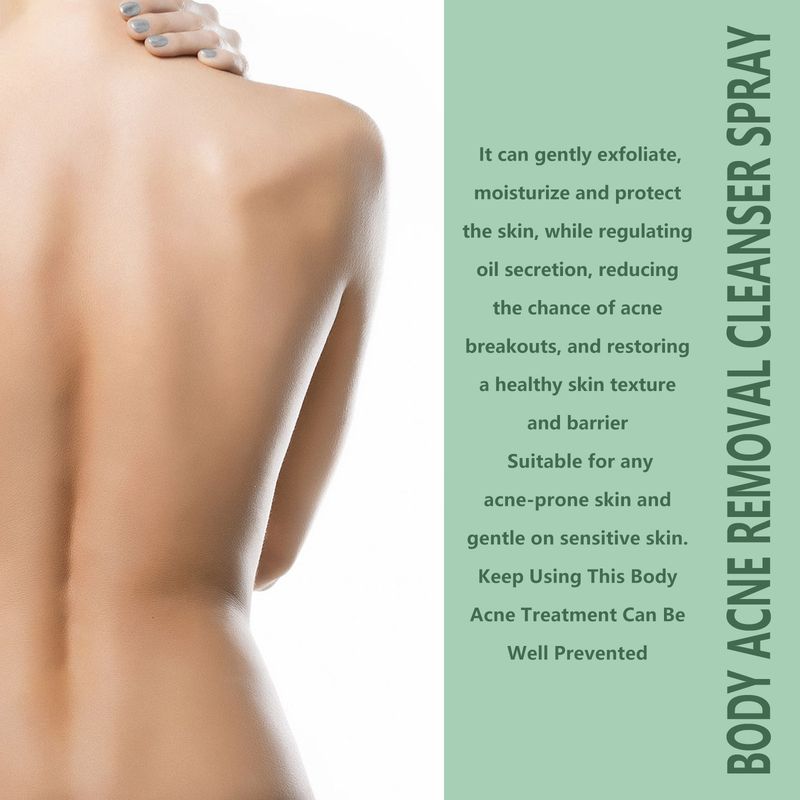 EELHOE djuprengörande kropp rygg och armar bleknar akne märke hud skönhet fuktgivande spray_voghion.com