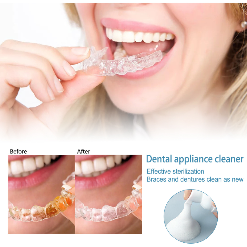 Fogszabályozási hab gyönyörű Cleaner Tooth Sleeve hab Cleaner Tooth Sleeve Folteltávolító Tisztító ápolás_voghion.com