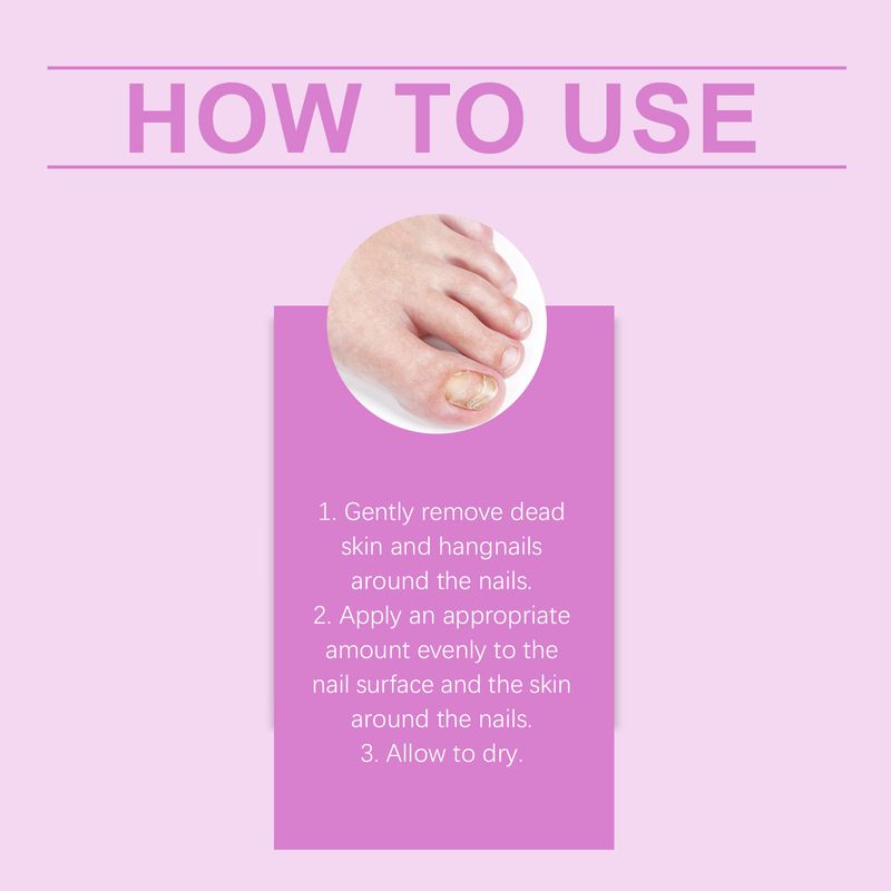 EELHOE Essence macht abgestorbene Haut weich, spendet Feuchtigkeit, nährt die Nagelränder, pflegt die Nagelhaut, pflegt den Nagel mit einem pflegenden Stift_voghion.com