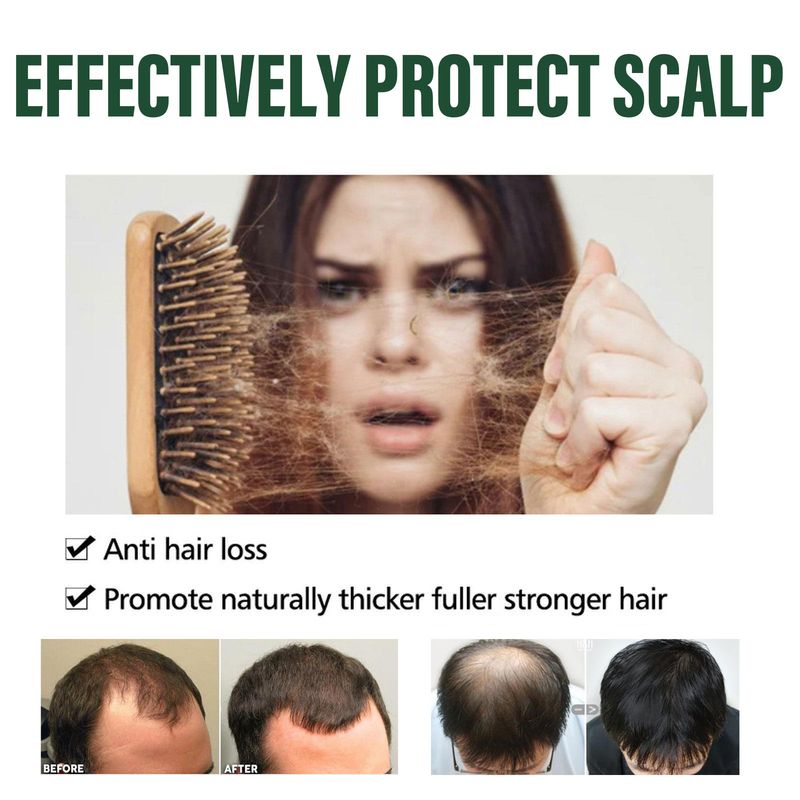 Set per la pulizia del cuoio capelluto, idratazione, morbidezza, lucentezza, rassodamento e cura dei capelli OceanAura Shampoo Series_voghion.com