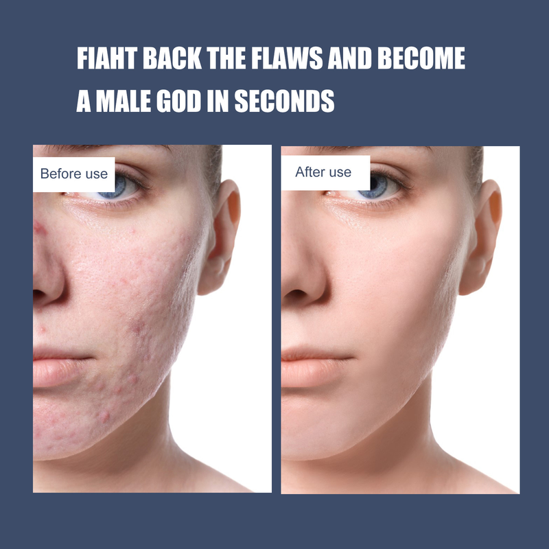 EELHOE Men's Oil Control Waterproof concealer Acne Print Natural Naked Makeup foundation make-up BB Cream Nourishes and_voghion.com