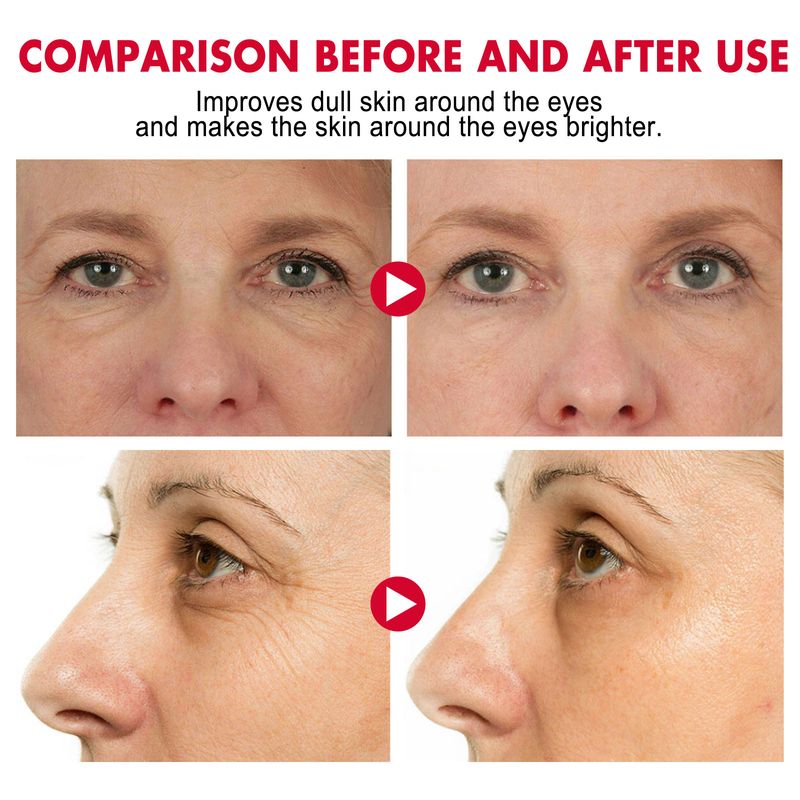 EELHOE Retinol Eye Stick, Moisturize Eye Skin To Improve Eye Fade Out Fine Lines, Crow's Feet Wrinkles_voghion.com