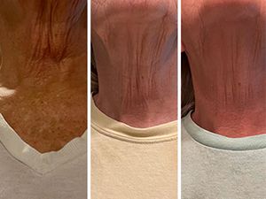 Κρέμα λαιμού GoPure Tightening Anti Aging για σύσφιξη των ρυτίδων, ομοιόμορφο τόνο δέρματος και ανόρθωση λαιμού - Περιέχει_voghion.com