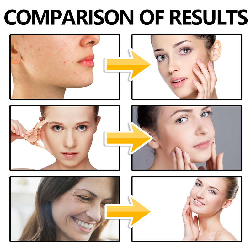 L'essenza viso Hoygi illumina, ripara la pelle opaca, schiarisce le macchie, reintegra l'umidità, idrata, resiste alle rughe_voghion.com