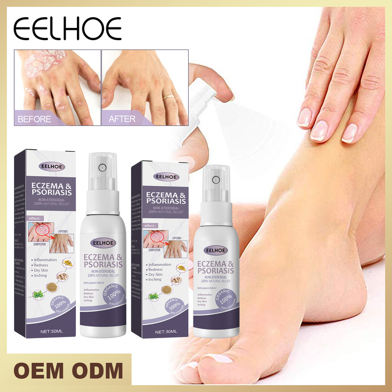 EELHOE hand and foot moss repair relieve itching skin care Knockout spray_voghion.com