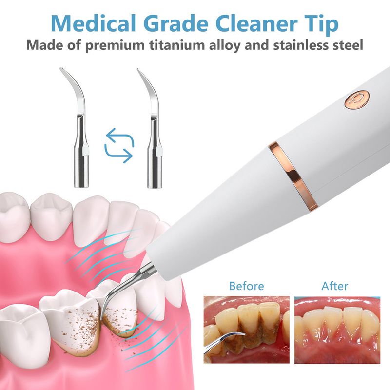 Portable ultrasonic cleaner for removing tartar tartar, USB rechargeable and luminous electric dental beauty device_voghion.com