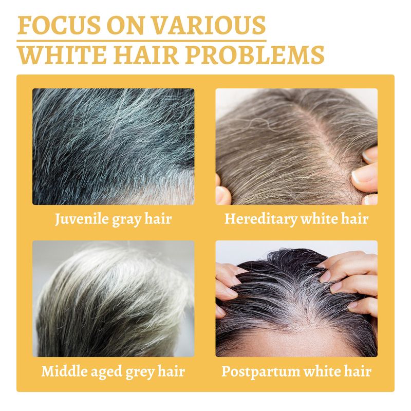Reying Hair, Hair Darkening , Organic Ganoderma Nutrient Hair Reverse 30ML Black Ganoderma Nourishes Hair And Strengthens It_voghion.com