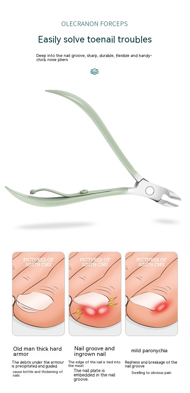 15-teiliges Set mit Nagelknipsern und Schönheitswerkzeugen, einschließlich Nagelknipser, Nagelknipser und Nagelwerkzeuge für Frauen zur Fußreparatur zu Hause_voghion.com