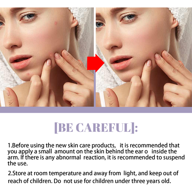 EELHOE Gréngen Téi Solid Oil Control Cleaning Akne Replenishing Moisturizing Gesiichtsmaske Stick_voghion.com