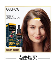 Ingefær Hår Vakker Vekstspray Tøft hår Massasje Hodebunn Tett hår Oppstrammende hårtap Forebygging Reparasjon Nærende_voghion.com