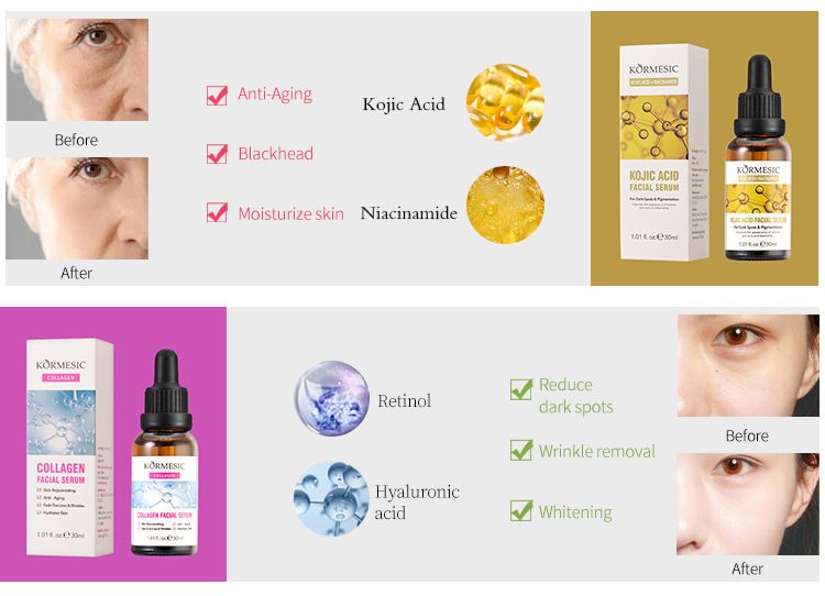 KORMESIC Serum Hydrating And Moisturizing Skin Facial 30g_voghion.com