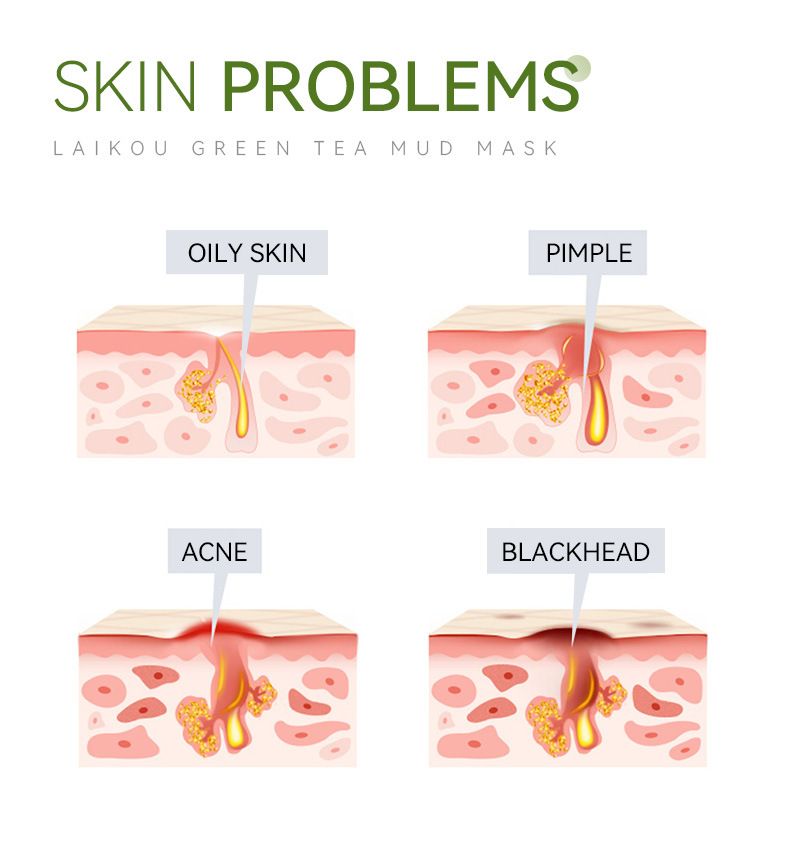 Laikou Green Tea Mud Mask 100g Cleansing Hydrating Moisturizing Mask Mud_voghion.com