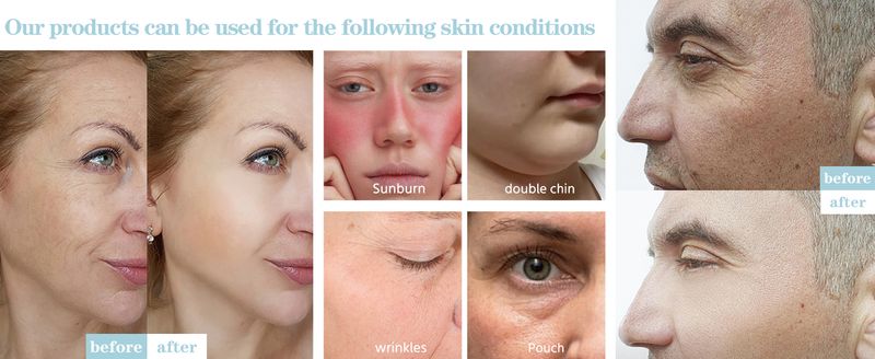 Upgraded Hot&Cold Dual-Mode Face Neck Massager, Anti-Aging&Wrinkles, Puffiness, Double Chin_voghion.com