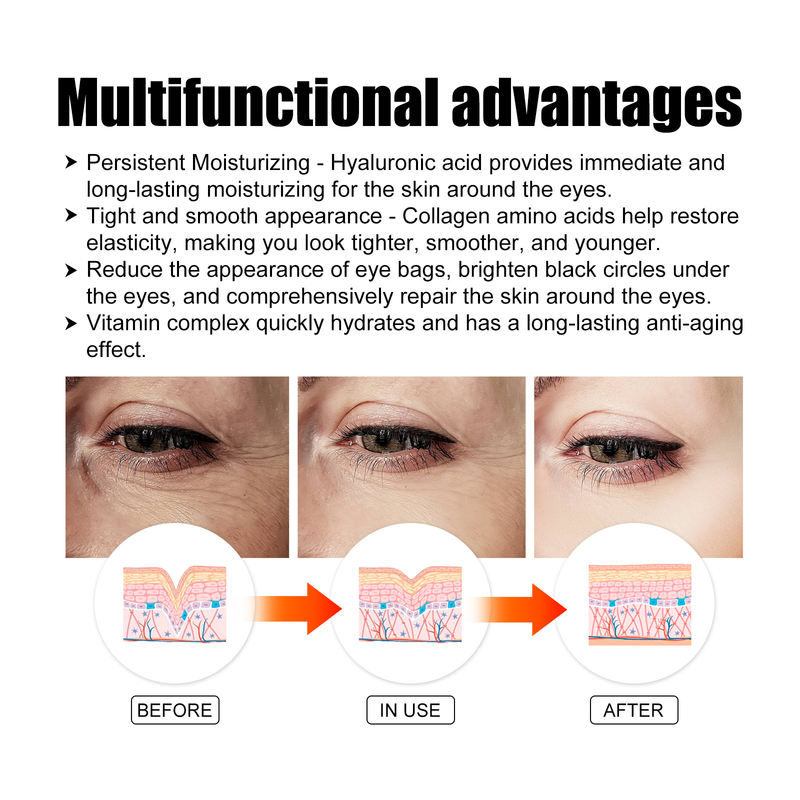 Collagen Eye Beautiful Mask Firming Eye Lines Eye Patch Staying up Late with Black Eyecircles and Eye Bags Moisturizin circles_voghion.com