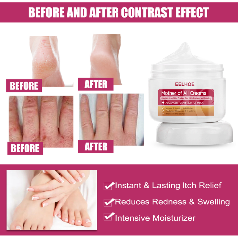 EELHOE Hand and Foot Moisturizing Repair Cream relieves itching, relieves itching, repairs dandruff, moisturizes and moisturizes the skin_voghion.com