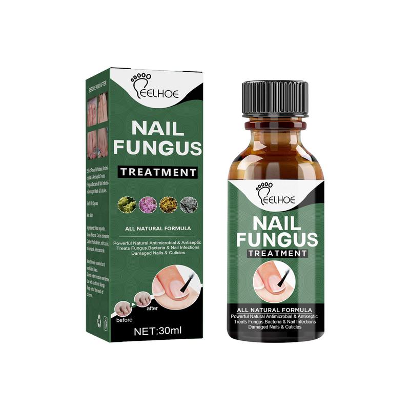 Grey Nail Beautiful Repair Thickening, Brightening, Soft Nail , Foot Care , Grey Nail Enhancement_voghion.com