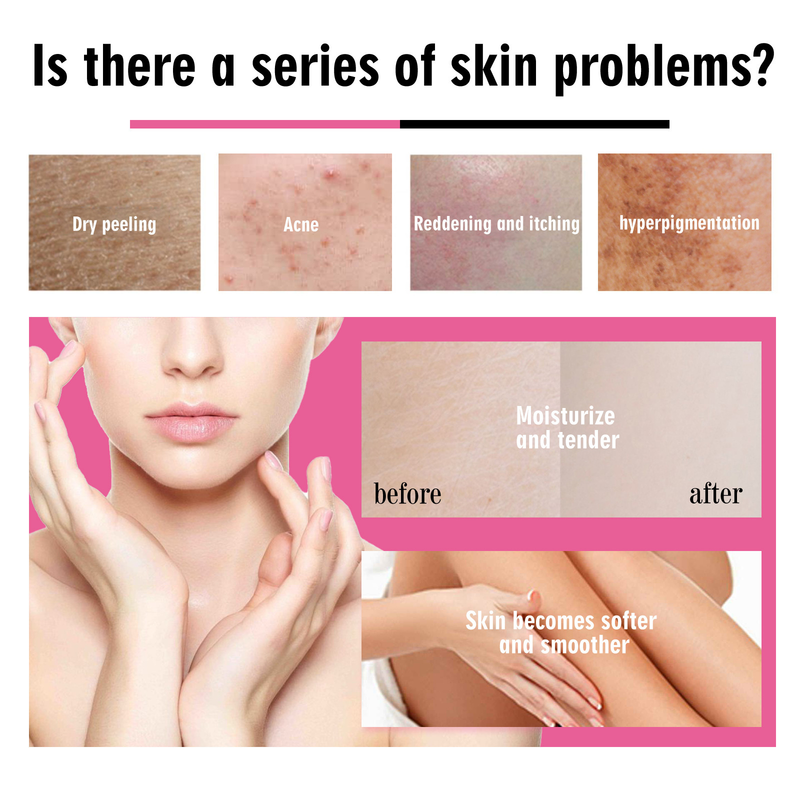 OUHOE La fragola migliora la secchezza, allevia il prurito, la melanina, ammorbidisce la pelle, l'olio per il corpo e l'olio essenziale per la cura della pelle_voghion.com