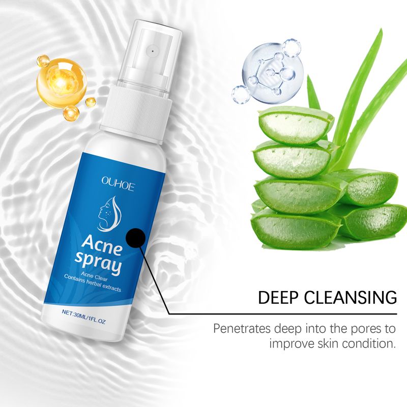 OUHOE Herbal Relief Spray For Facial Discomfort Herbal Essence Gently Moisturizes And Soothes Skin_voghion.com