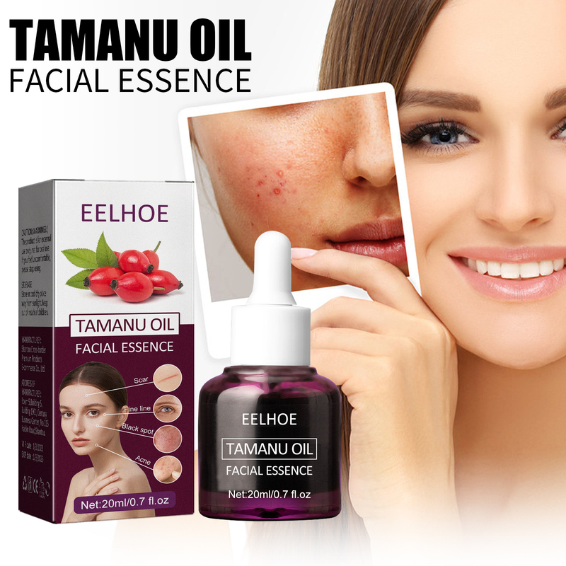 Qiongya Begonia Belle huile essentielle élimine l'acné, ferme la bouche, rétrécit les pores, répare les muscles sensibles et_voghion.com