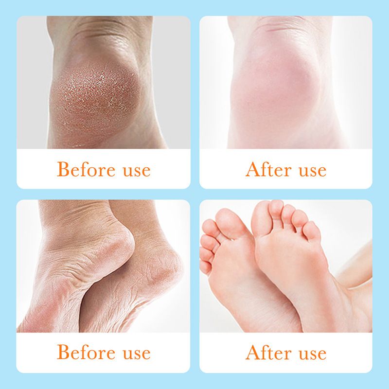 SADOER Foot Gel in Full English Improves Anti Cracking Moisturizing Beads_voghion.com