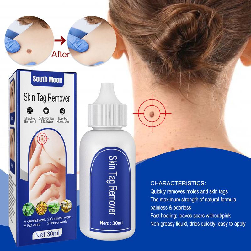 South Moon Clear Genital Flat Barb Removing Filamentous Verruca, Herbal Verruca Suppressing Liquid_voghion.com