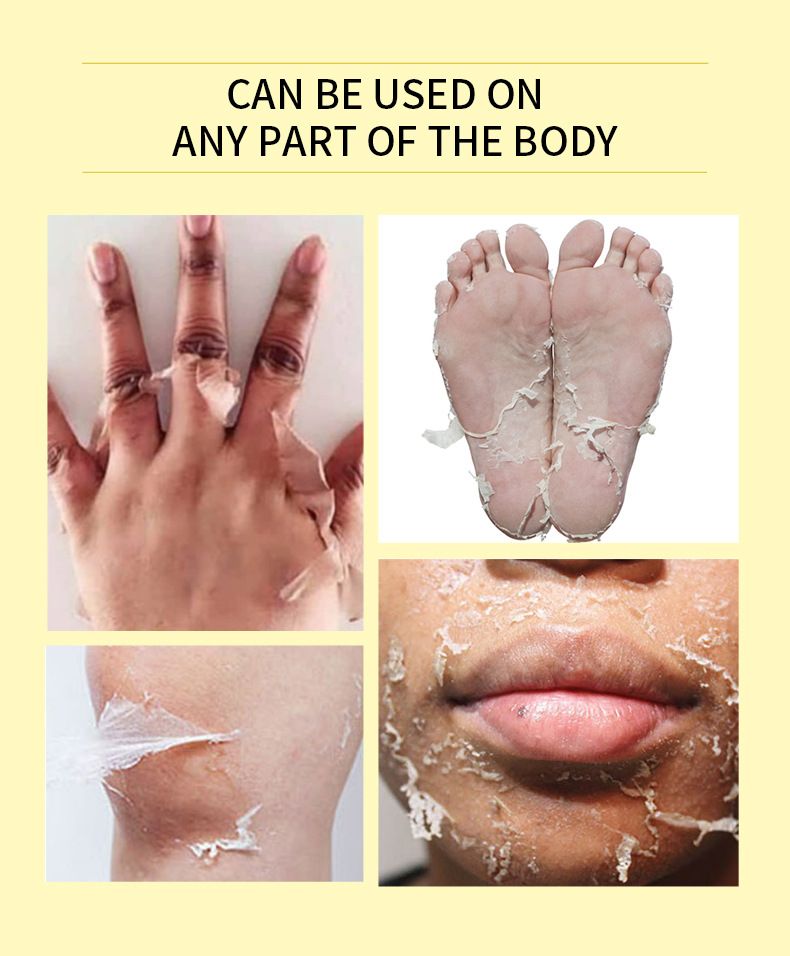 Bsncpley Peeling Yağı Beyazlatıcı Peeling Peeling El Yüz Vücut Peeling Esans Yağı Cildi Yatıştırır_voghion.com