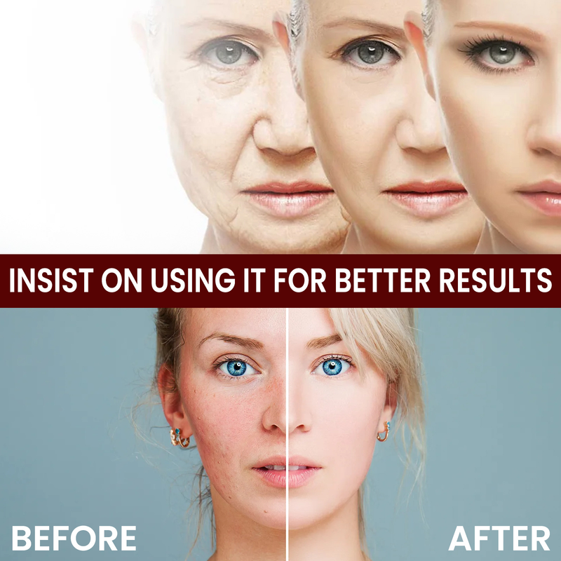 OUHOE White Rice Skin Rejuvenating&Moisturizing Cream to weaken fine lines, tighten pores, remove acne, moisturize,_voghion.com