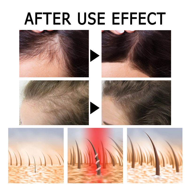Dense Hair Beautiful Anping Bottle, Strong and Tough, Repairing and Preventing Hair Loss, Root Fixing and Thick Hair C_voghion.com