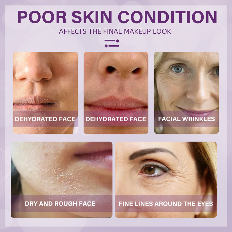 Facial Moisturizing Beautiful Cream Firms, Fades Wrinkles, Moisturizes, Easily Absorbs, Improves Dry Skin face cream_voghion.com