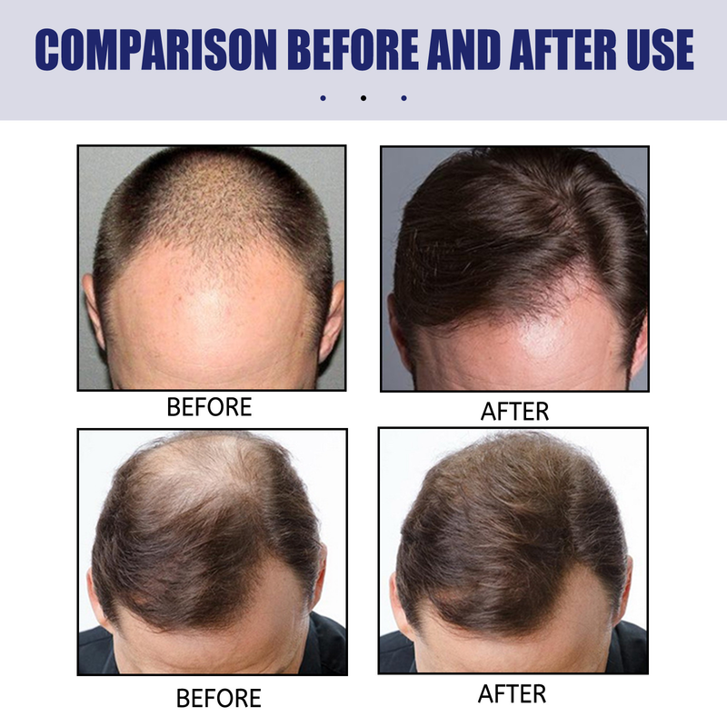 East Moon foam Men's Dense Moisturizing Care Djupreparation hårrotssäckar_voghion.com