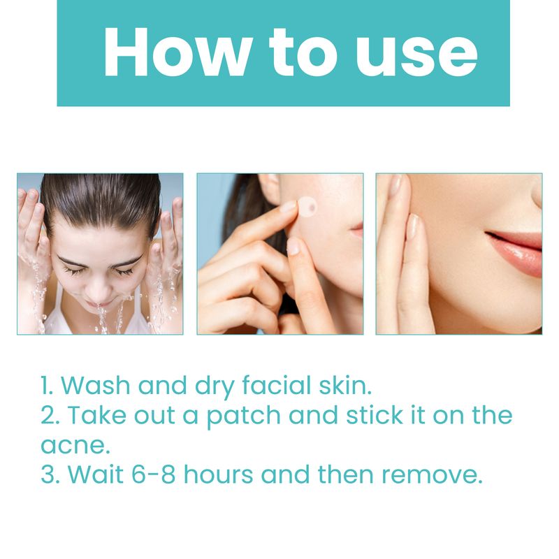 West&Month Acne Patch (300pcs) Repairs Acne And Blackheads, Cleans Pores, Is Invisible, Breathable, Concealer And Waterproof_voghion.com