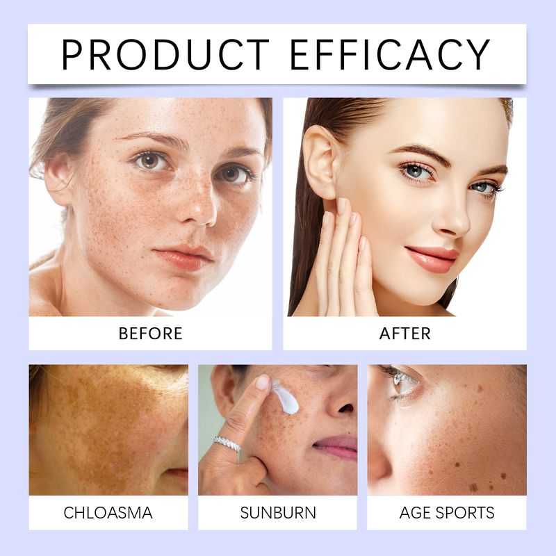 Ouhoe Facial Spot Remover, Hydra Nourishing Moisturizing Moisturizing And Smoothing Skin Skin Care Cream_voghion.com