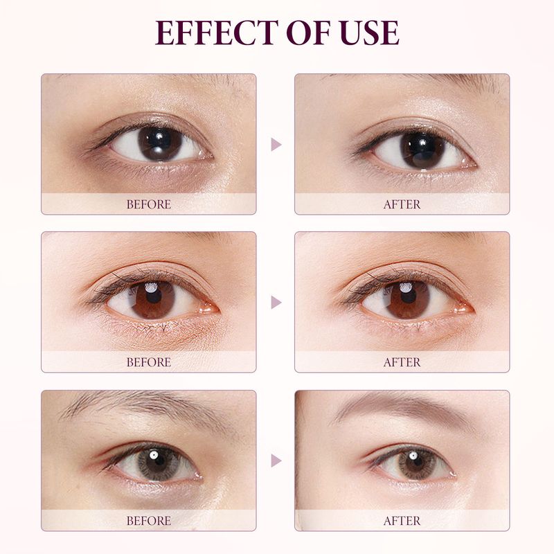 EELHOE Mango Eye Cream reduces wrinkles, bags, dark circles, anti wrinkle, moisturizing, firming, and smoothing the skin_voghion.com