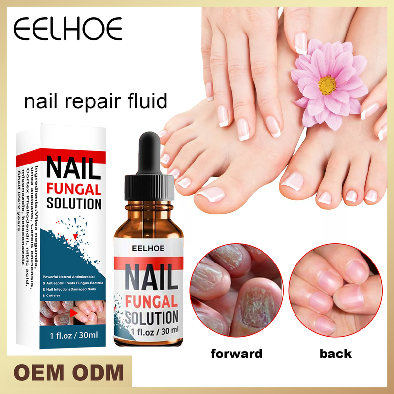 EELHOE Hand Foot Care Repair Grey Nail Liquid Thickens Soft and Brightens Nails_voghion.com