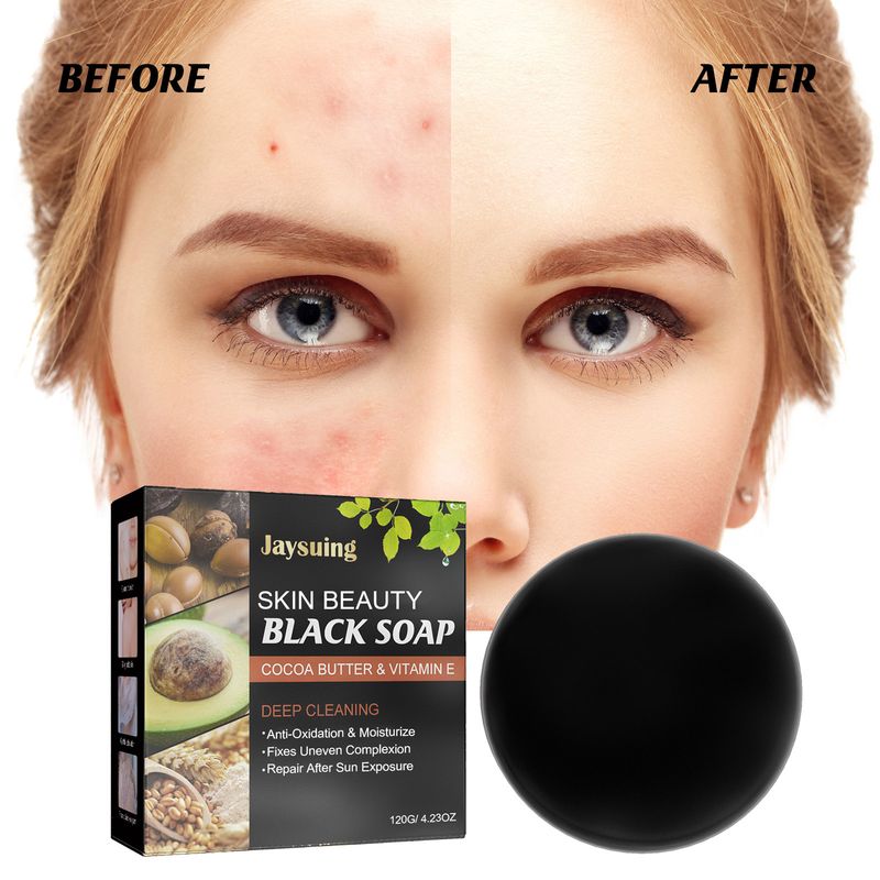 Jaysuing Removing Skincare Handmade Soap for Facial Cleansing and Anti Acne Treatment_voghion.com