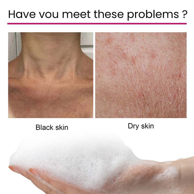 Whitening Soap Dark Spot Corrector Underarm Face Body Cleansing Bleaching Moisturizing Brighten Collagen Soap with Niacinamide_voghion.com