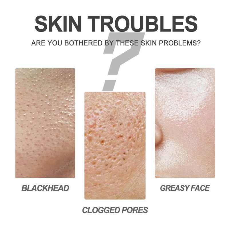 Maschera EELHOE Set per la cura della zona T con olio per l'acne e punti neri per la pulizia del naso alla fragola_voghion.com