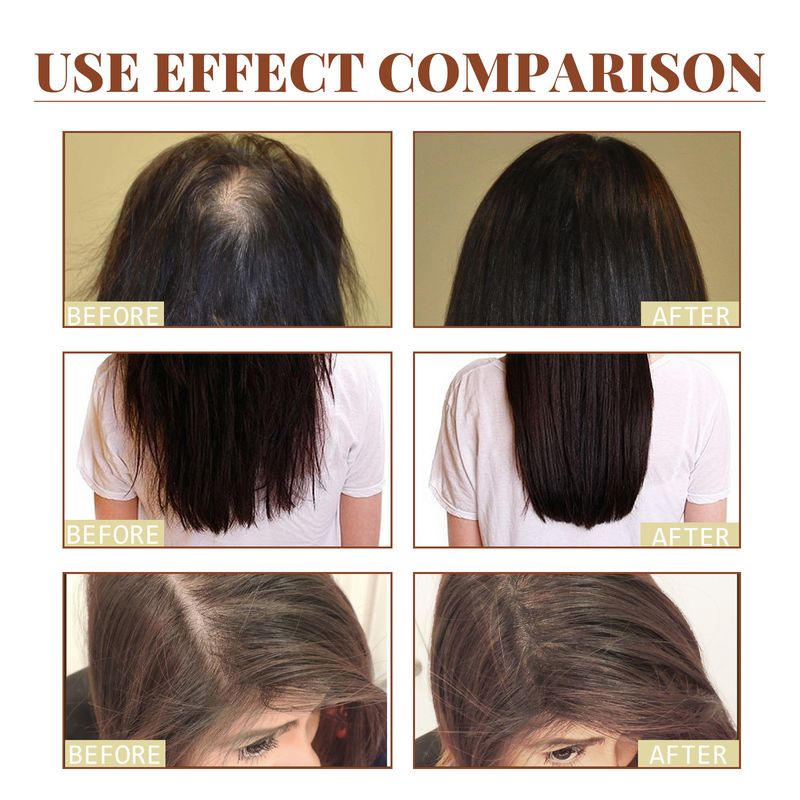 L'olio per la cura della batana HOEGOA nutre il cuoio capelluto, idrata i capelli secchi e ruvidi e ammorbidisce la coda dei capelli_voghion.com
