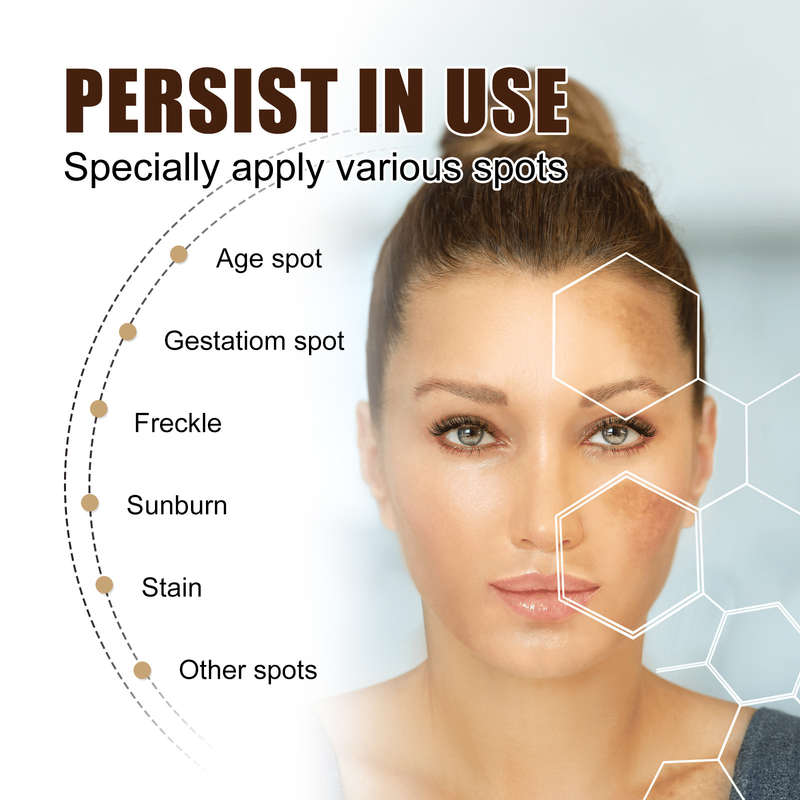 Cream Beautiful Freckle Moisturizes and Moisturizes Freckles, Blackspots, Yellowish Brown Spots, and Melanin Whitening s,_voghion.com