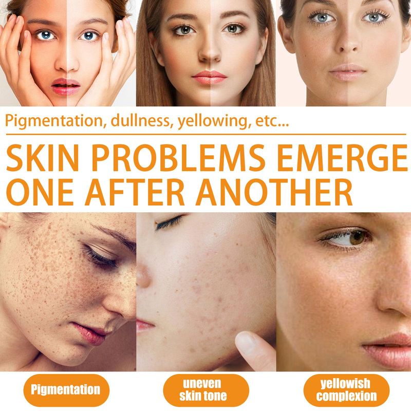 Vitamina C per il viso Siero viso schiarente Acido ialuronico Rimozione macchie scure Prodotti per la cura della pelle coreana Cura della pelle_voghion.com