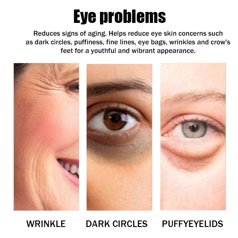 Eye To Lighten Dark Circles, Fine Lines, Bags Under Eyes, Resist Wrinkles, Lift Tighten Skin, And Brighten The Area With_voghion.com