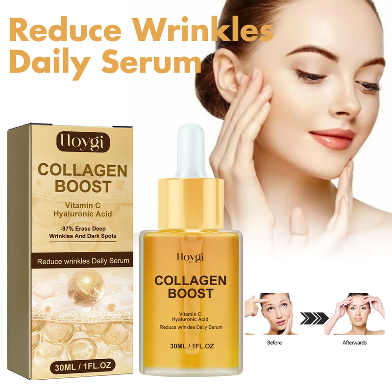 Hoygi Collagen Anti Wrinkle per sbiadire le linee sottili della testa, idratare e rassodare l'essenza della pelle_voghion.com