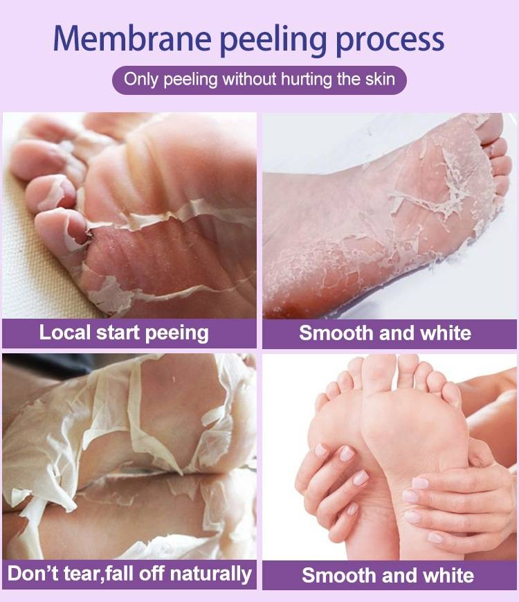 Patch exfoliant pour les pieds à la lavande, avec exfoliation douce des callosités, soin des pieds, masque pour les pieds_voghion.com