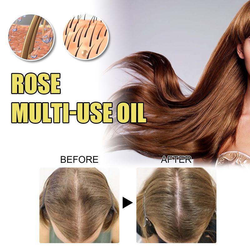 EELHOE Rosenblüten-Ätherisches Öl Befeuchtet Körperhaut, Pflegt Haar Und Verhindert Fußrissen – Ein Vielseitiges Pflegeöl_voghion.com