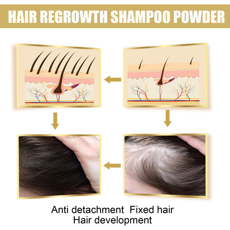 EELHOE Ingwer-Shampoo beugt Haarausfall vor, fördert das Wachstum, reinigt, kontrolliert Öl, spendet Feuchtigkeit und pflegt dichtes Haar_voghion.com