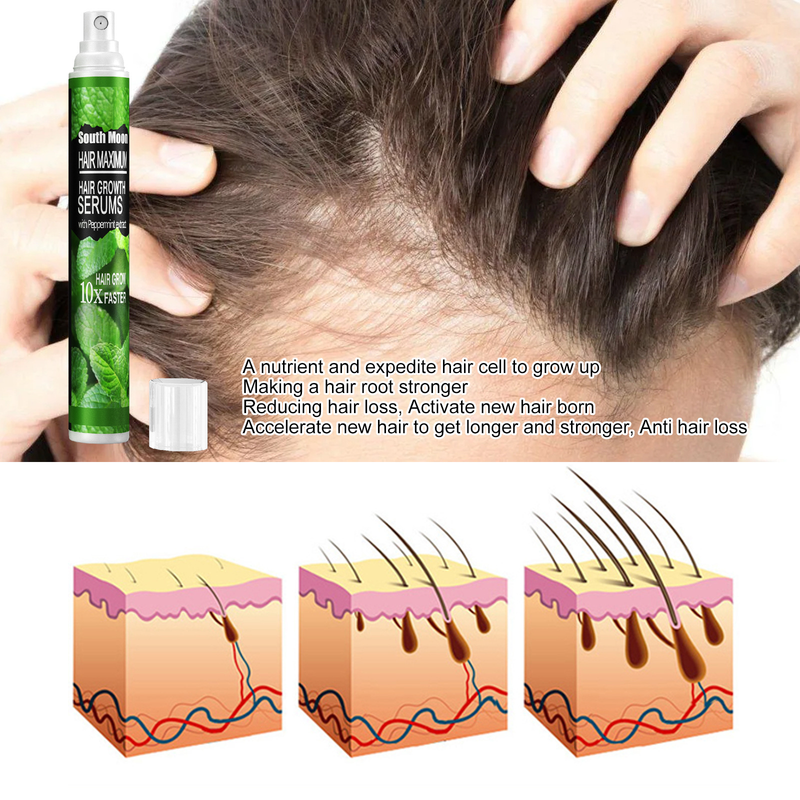 10/30 ml Haarwachstumsspray, schnell wachsendes Haaröl, Haarausfallkur für dünner werdendes Haar, Wachstumsspray, Produkte, Haarpflege für Frauen, Männer, Männer_voghion.com
